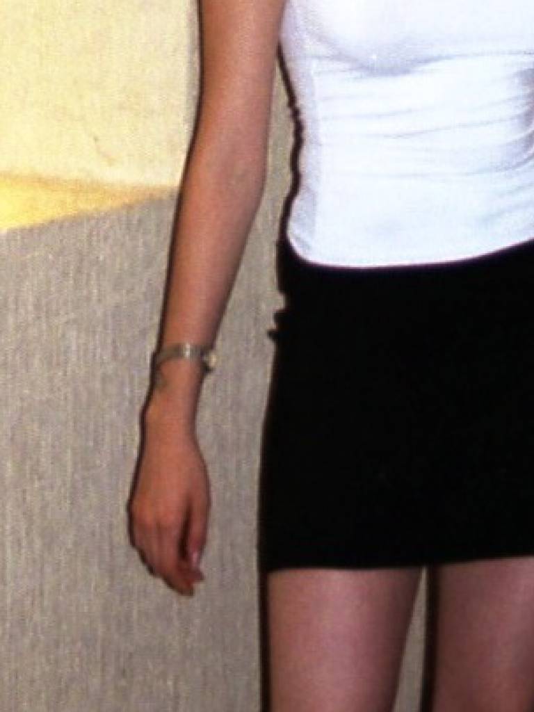 Photo de Alison